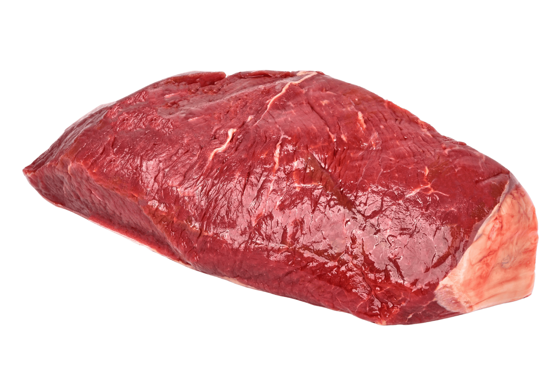 Cadera
